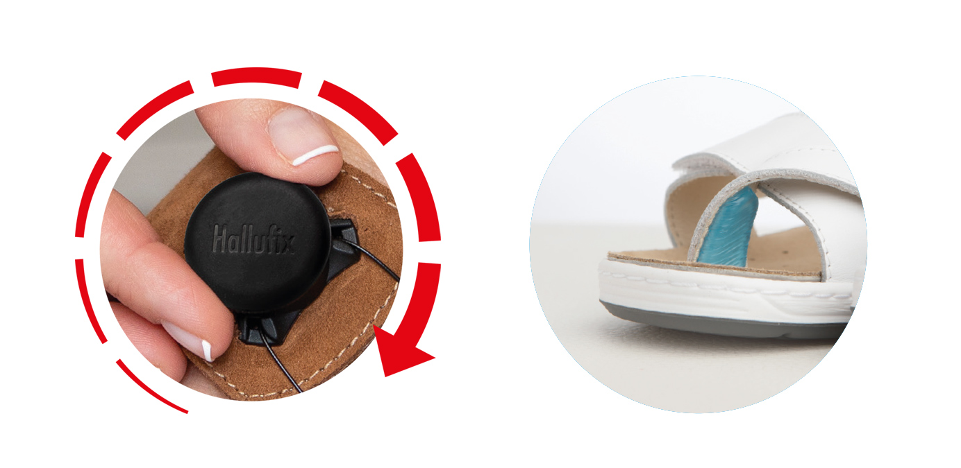 Sand&aacute;ly Hallufix Bunion Treatment