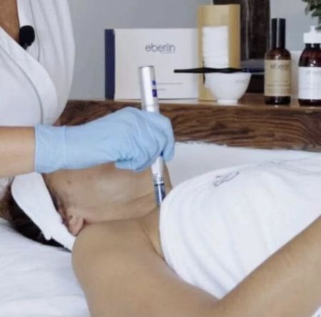 Školení - Microneedling od Eberlin Biocosmetics